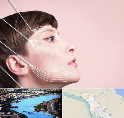 اندولیفت پیشانی در خرمشهر