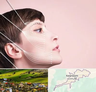اندولیفت پیشانی در کلاردشت