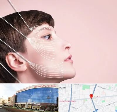 اندولیفت پیشانی در نصف راه تبریز