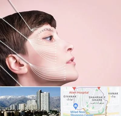 اندولیفت پیشانی در شهرک غرب 