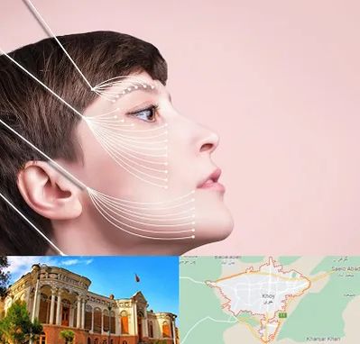 اندولیفت پیشانی در خوی