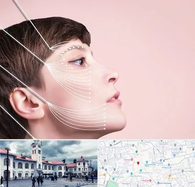 اندولیفت پیشانی در میدان شهرداری رشت