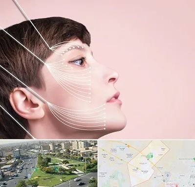 اندولیفت پیشانی در کمال شهر کرج 