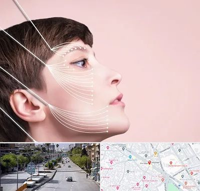 اندولیفت پیشانی در خیابان زند شیراز