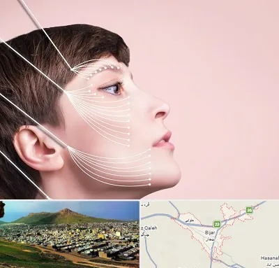اندولیفت پیشانی در بیجار