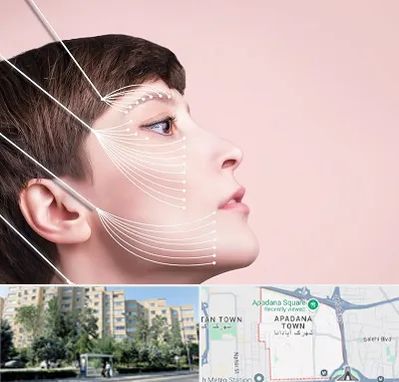 اندولیفت پیشانی در آپادانا