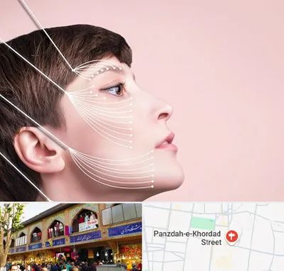 اندولیفت پیشانی در 15 خرداد