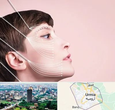 اندولیفت پیشانی در ارومیه