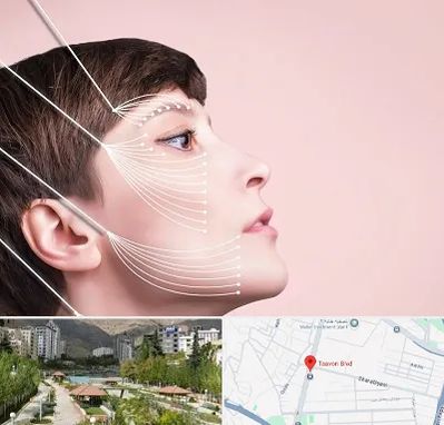 اندولیفت پیشانی در بلوار تعاون