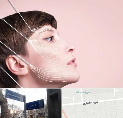 اندولیفت پیشانی در سی متری جی