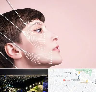 اندولیفت پیشانی در هفت تیر مشهد 