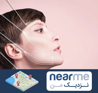 اندولیفت پیشانی در نزدیک من