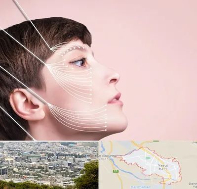 اندولیفت پیشانی در یاسوج