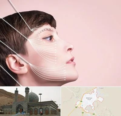 اندولیفت پیشانی در شهرضا