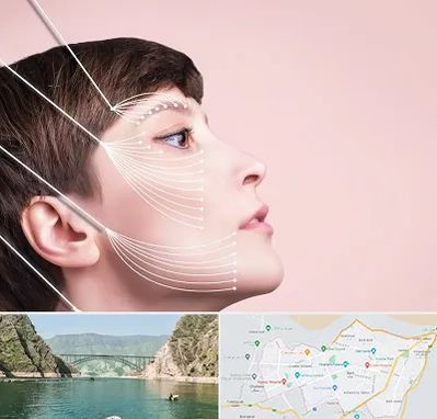 اندولیفت پیشانی در ایلام