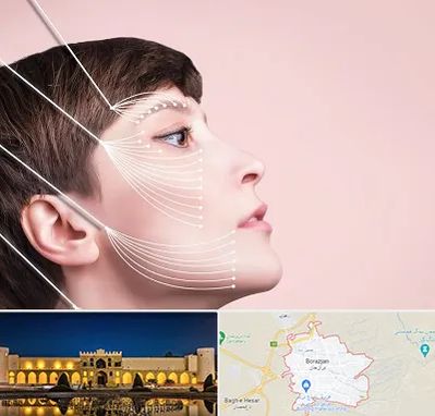 اندولیفت پیشانی در برازجان