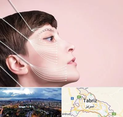 اندولیفت پیشانی در تبریز