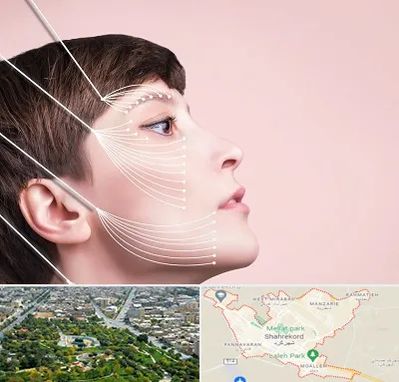 اندولیفت پیشانی در شهرکرد