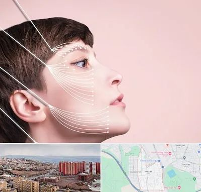 اندولیفت پیشانی در سهند تبریز