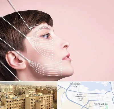 اندولیفت پیشانی در جنوب غرب تهران