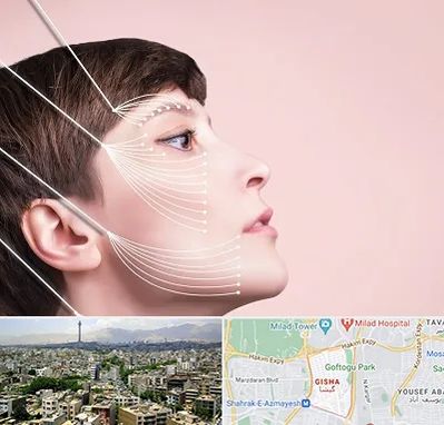 اندولیفت پیشانی در گیشا 