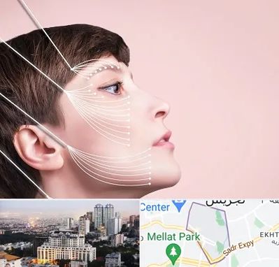 اندولیفت پیشانی در الهیه 