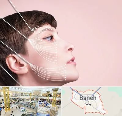 اندولیفت پیشانی در بانه