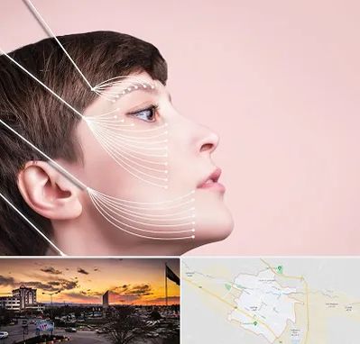 اندولیفت پیشانی در قوچان