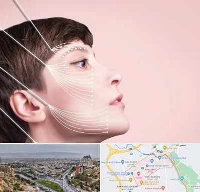 اندولیفت پیشانی در معالی آباد شیراز