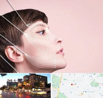 اندولیفت پیشانی در بلوار سجاد مشهد 