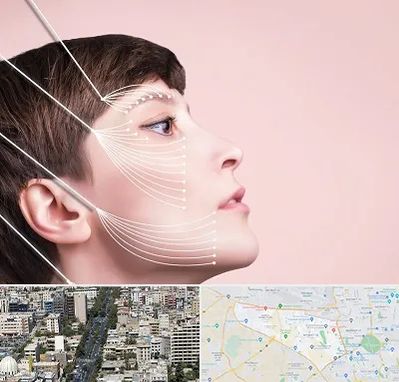 اندولیفت پیشانی در منطقه 18 تهران 