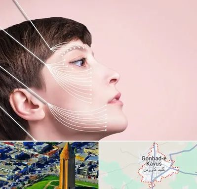 اندولیفت پیشانی در گنبد کاووس