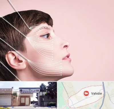 اندولیفت پیشانی در وحیدیه شهریار