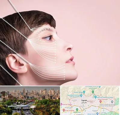 اندولیفت پیشانی در منطقه 1 تهران 