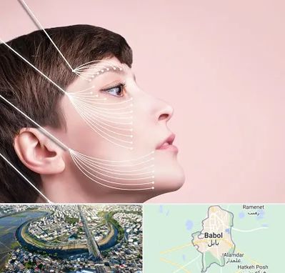 اندولیفت پیشانی در بابل