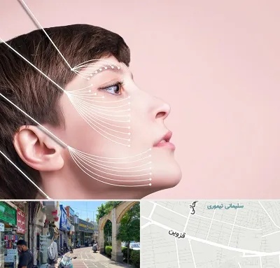 اندولیفت پیشانی در خیابان قزوین