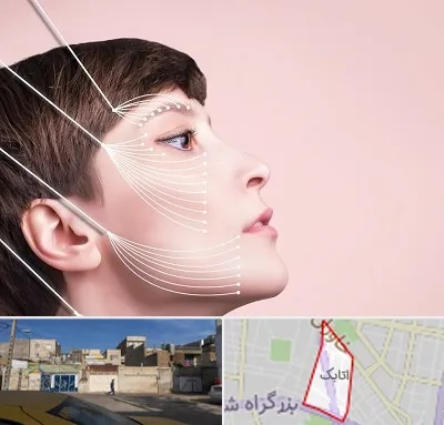 اندولیفت پیشانی در اتابک