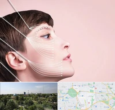 اندولیفت پیشانی در منطقه 16 تهران 