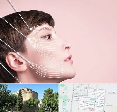 اندولیفت پیشانی در مرداویج اصفهان