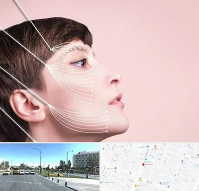 اندولیفت پیشانی در بلوار کلاهدوز مشهد 