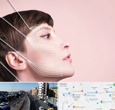 اندولیفت پیشانی در پیروزی 