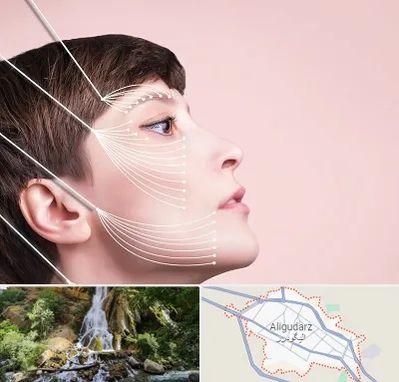 اندولیفت پیشانی در الیگودرز