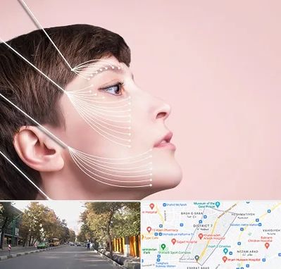 اندولیفت پیشانی در شریعتی 