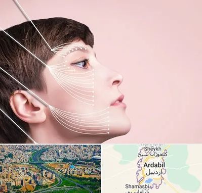 اندولیفت پیشانی در اردبیل