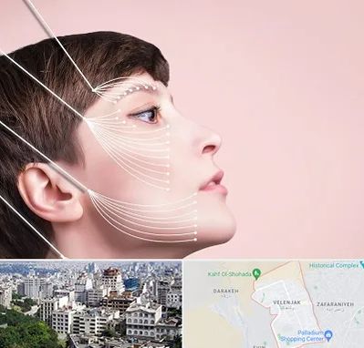 اندولیفت پیشانی در ولنجک 