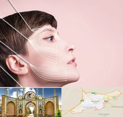 اندولیفت پیشانی در سمنان