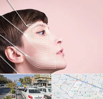 اندولیفت پیشانی در مفتح مشهد