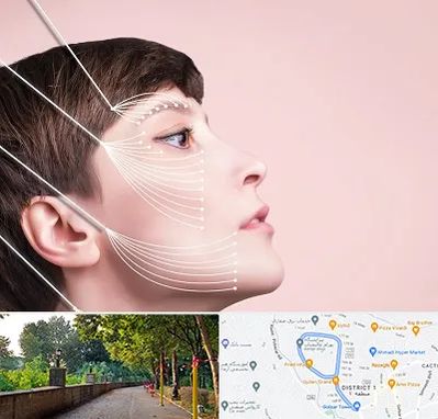 اندولیفت پیشانی در فلکه گاز رشت