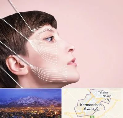 اندولیفت پیشانی در کرمانشاه