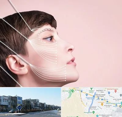 اندولیفت پیشانی در شریعتی مشهد